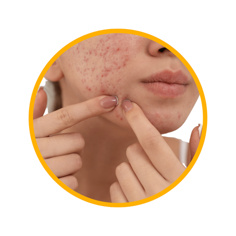Clear Skin. Clear Science.