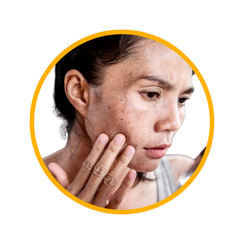 Pigmentation Solutions for Even Skin Tone skin tone correction